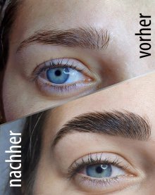 Browliftung bei Charisma